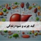 کبد چرب