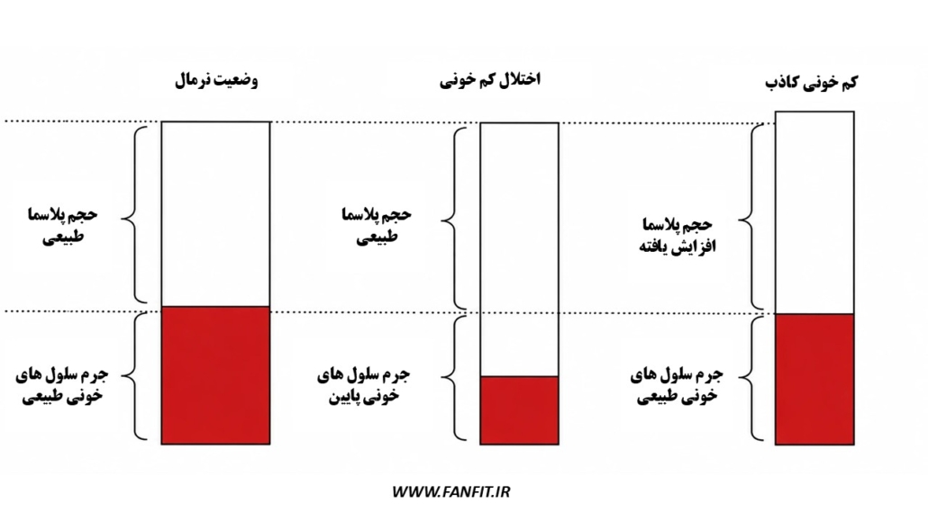 کم خونی